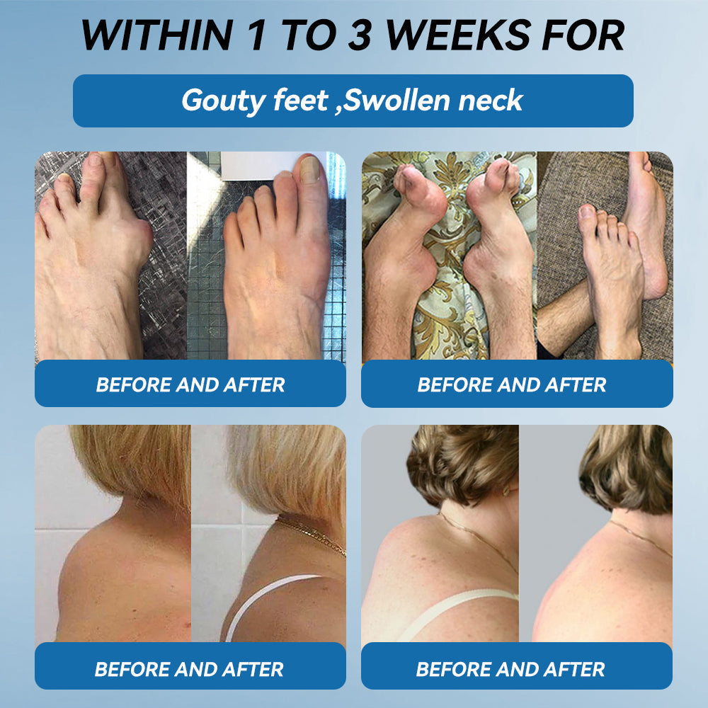 𝐅𝐃𝐀 𝐀𝐩𝐩𝐫𝐨𝐯𝐞𝐝👩‍⚕️|LOVILDS® 𝑩𝐏𝐂-𝟏𝟓𝟕 𝐉𝐨𝐢𝐧𝐭 𝐇𝐞𝐚𝐥𝐢𝐧𝐠 𝐂𝐫𝐞𝐚𝐦🦴 Relief for Arthritis, Neuropathy, Rheumatism & Sports Injuries & 𝐌𝐨𝐫𝐞