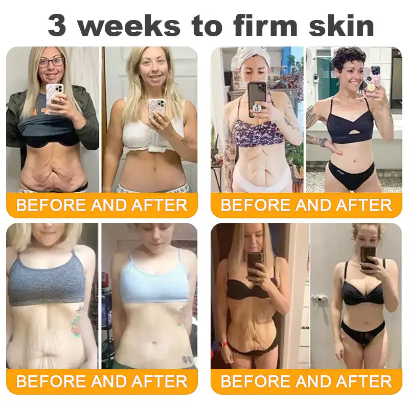 ✨FDA Approved:LOVILDS™Bee Toxin Skin Restoration Cream — 🔥Limited Time 70% OFF🔥