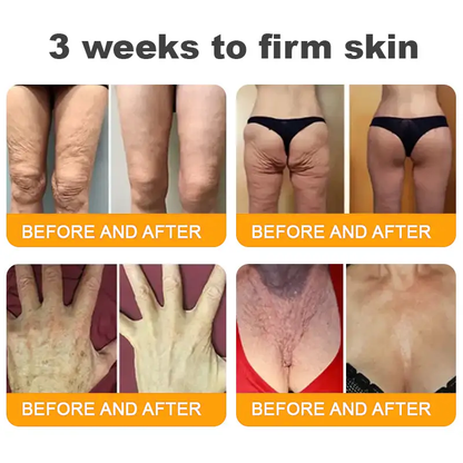 ✨FDA Approved:LOVILDS™Bee Toxin Skin Restoration Cream — 🔥Limited Time 70% OFF🔥