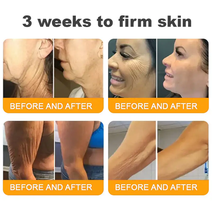 ✨FDA Approved:LOVILDS™Bee Toxin Skin Restoration Cream — 🔥Limited Time 70% OFF🔥