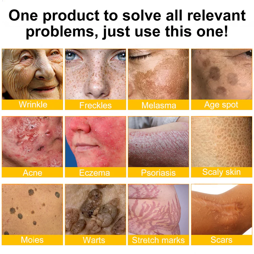 ✨FDA Approved:LOVILDS™Bee Toxin Skin Restoration Cream — 🔥Limited Time 70% OFF🔥